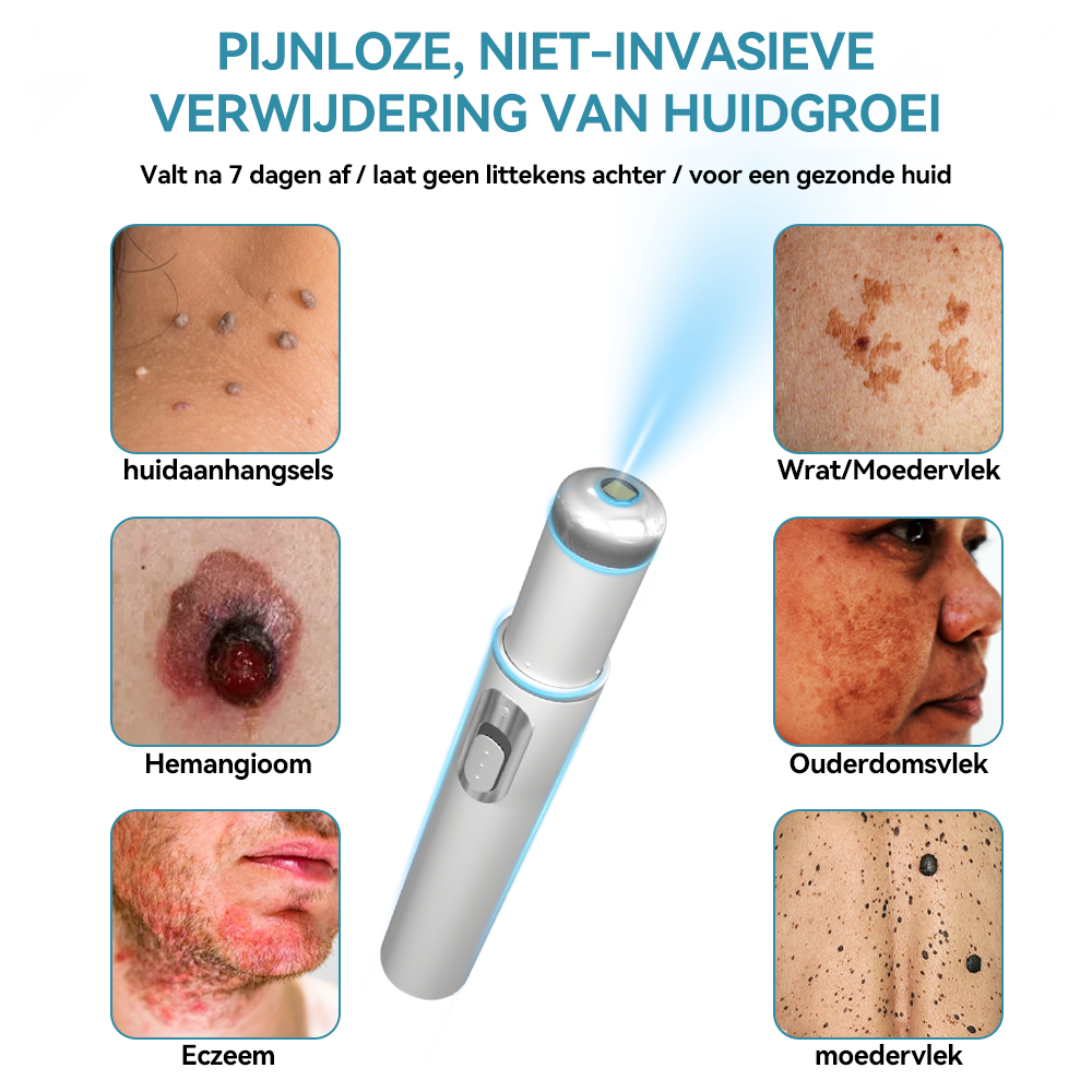 Bikenda® laserpen 💕(met CO₂-lasertechnologie – effectief voor het verwijderen van moedervlekken, wratten, huidflapjes, pigmentvlekken en andere onvolkomenheden)