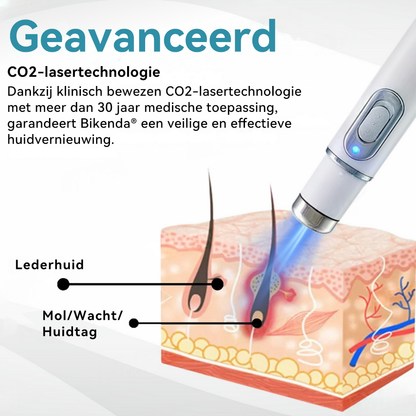 Bikenda® laserpen 💕(met CO₂-lasertechnologie – effectief voor het verwijderen van moedervlekken, wratten, huidflapjes, pigmentvlekken en andere onvolkomenheden)